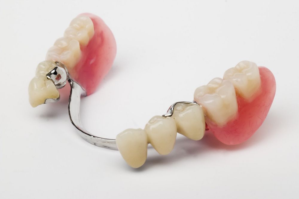 Zahnprothese der Backenzähne