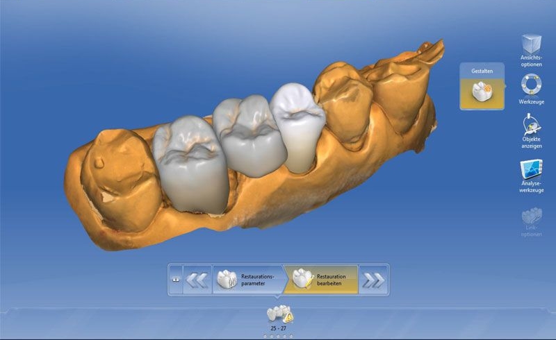 CAD/CAM Zahnarzt Wien