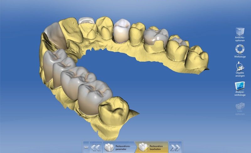 CEREC Zahnarzt Wien