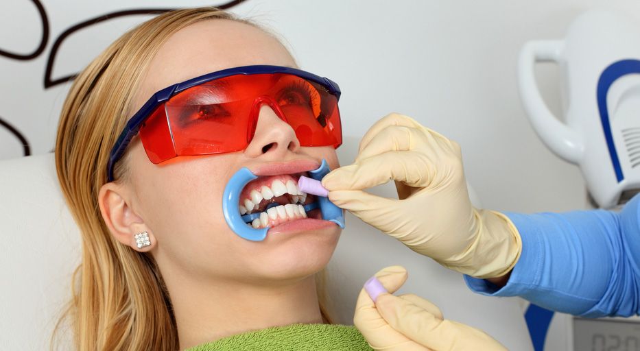 Bleaching Dentist Vienna